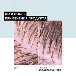Loreal  Скальп Анти-Ойл шампунь-маска 250мл