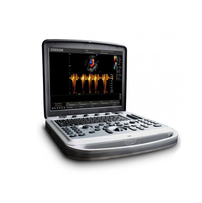 УЗИ аппарат Chison SonoTouch 80 (SonoBook 6)