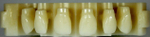 Блок- заготовка Re-Fine Acrylic PMMA Yamahachi А2-20