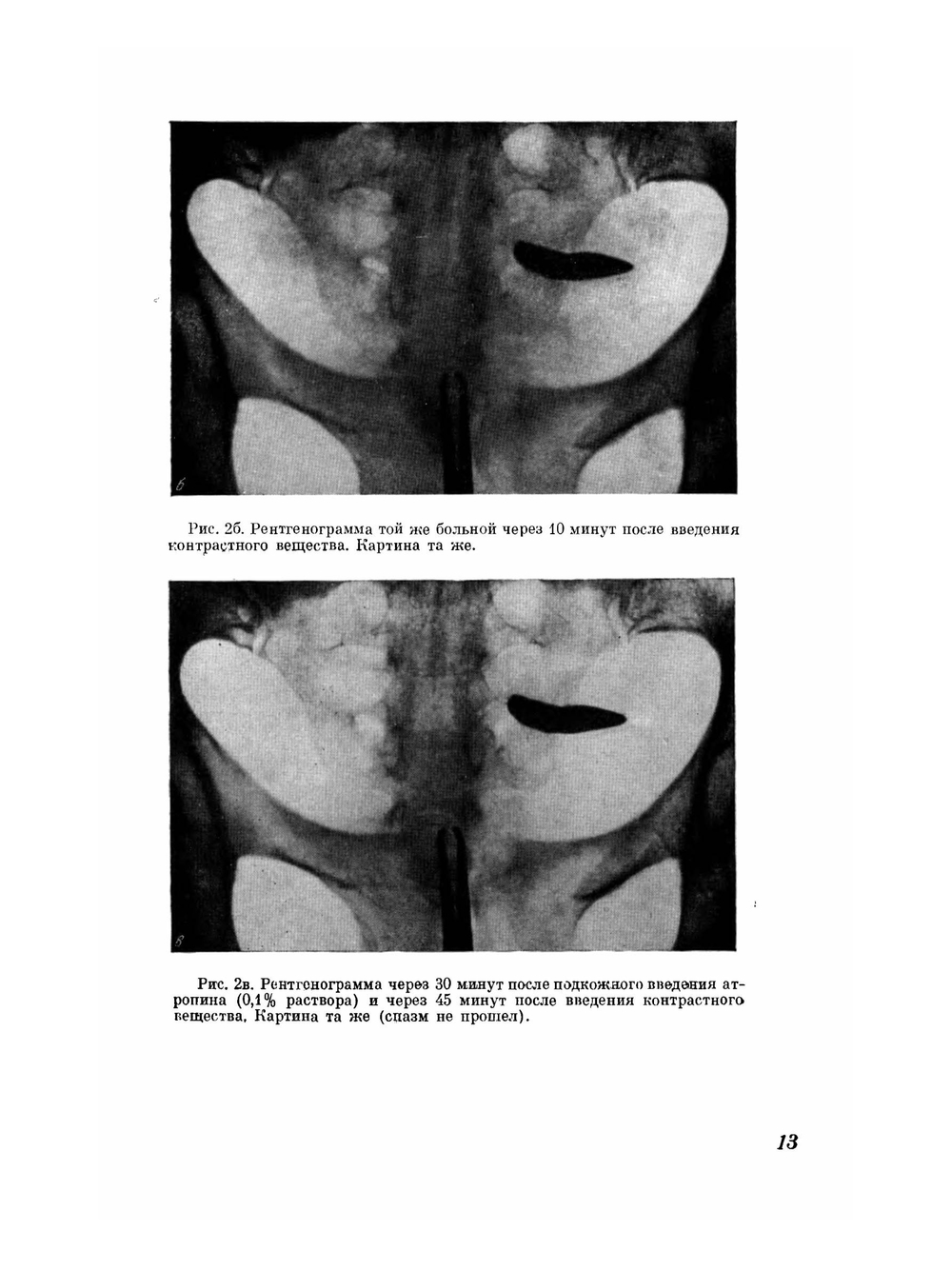 Атлас гистеросальпингографии | М.М. Абрамова