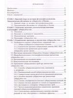 Туберкулез глаз и сходные с ним заболевания. Руководство для врачей. 2е изд.