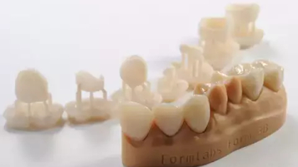 3D-печать постоянных коронок с помощью SLA 3D-принтера Form 3B и Permanent Crown Resin