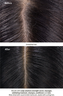 Aveda Scalp Solutions Refreshing Protective Mist - защитный спрей для жирных волос /   100  ml  / GTIN 18084040614