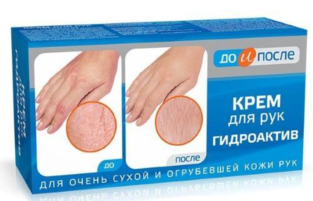 До и после крем Гидроактив для рук 100 мл.