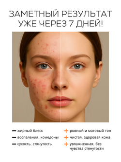 МЯГКИЙ КРЕМ-ГЕЛЬ ДЛЯ УМЫВАНИЯ С САЛИЦИЛОВОЙ КИСЛОТОЙ 0,5%