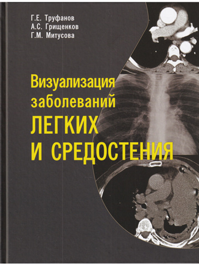 Визуализация заболеваний легких и средостения