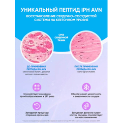 VEROVER PHARMA Венапепт пептид IPH AVN, 30 шт.