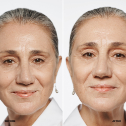 Clinique Even Better Makeup SPF 15 Evens and Corrects - Корректирующая основа SPF 15, 30 ml