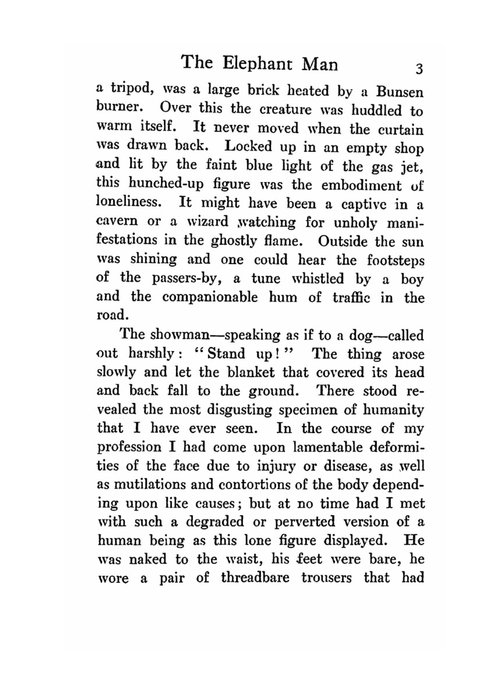 The Elephant Man and Other Reminiscences | F. Treves