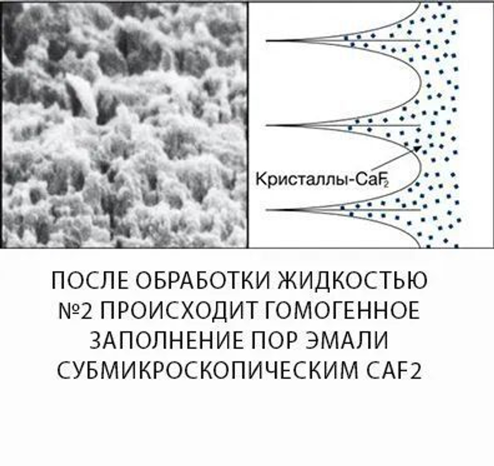 Эмаль герметизирующий ликвид (5 мл + 5 мл) HUMANCHEMIE