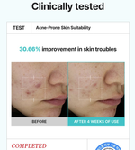 Крем с 5% азелаиновой икслотой SKIN&LAB Azelaic acid balancung moisturizer, 100мл