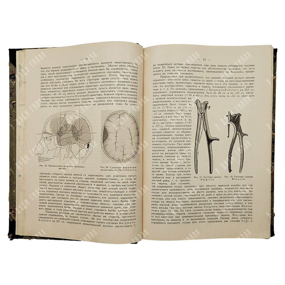 Тихов П. И. Частная хирургия. В 2-х томах, 1916.