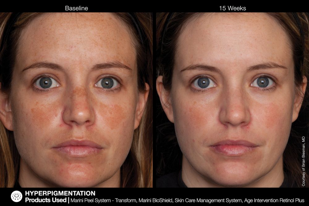 JAN MARINI AGE INTERVENTION RETINOL+ 0,5% Крем-акселератор с ретинолом 0,5% для борьбы с видимыми возрастными изменениями