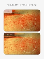 Arocell Солнцезащитная сыворотка с транексамовой кислотой, мелатонином и глутатионом SPF50 Mela TXA Sun Serum 40 мл