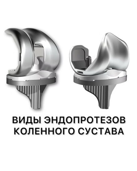 Эндопротез коленного сустава виды