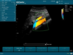 Аппарат УЗИ Edan U2 (без УЗИ датчиков)