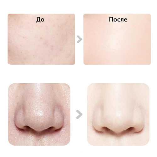 Крем Perfect BB Cream, 50 мл | iSOV Sorex