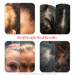 HAIRtamin, Сыворотка для кожи головы, 60 мл (2 жидк. Унции)