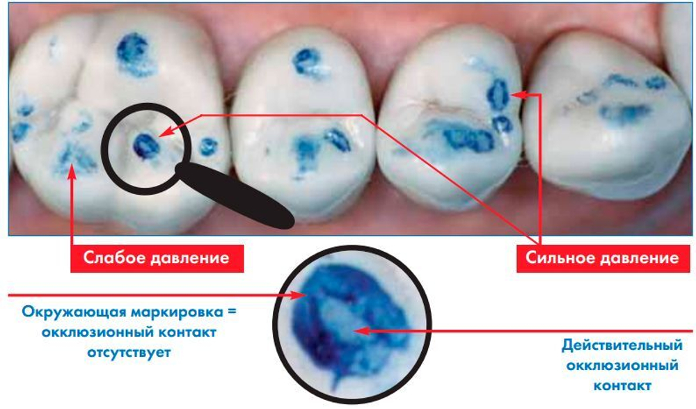 Артикуляционная бумага Bausch BK 01 синяя /200 мкрн - 300 листов
