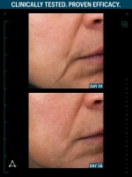 Лифтинг- Сыворотка Allies Of Skin Multi Peptides & GF Advanced Lifting Serum 30 ml