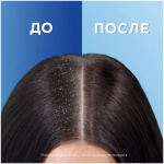 Head & Shoulders Шампунь против перхоти Цитрус, для жирных волос, 200 мл