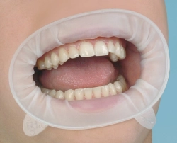 OptraGate