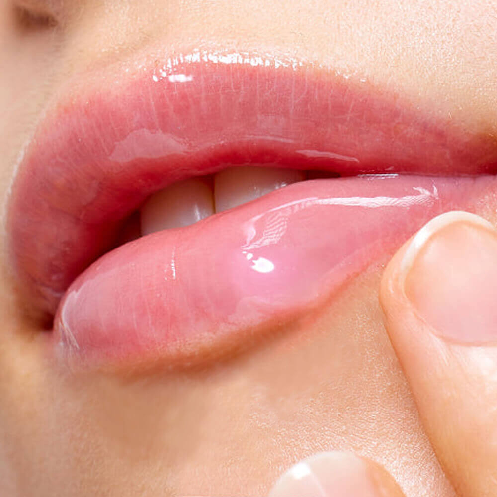 Arencia Глазированная маска для губ с коллагеном и медом - Honey Glazed Collagen Lip Mask, 15мл.