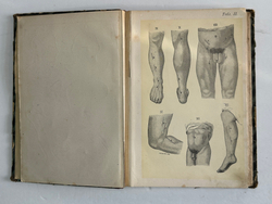 Пирогов Н. Атлас "Анатомия артериальных стволов и фиброзных фасций", 1837г. Дерпт, 54 л. цв. таб.