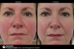 JAN MARINI SKIN CARE MANAGEMENT SYSTEM (NORMAL-COMBO) SPF33