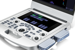 УЗИ аппарат Edan Acclarix AX3