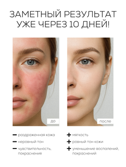 СЫВОРОТКА ДЛЯ ЧУВСТВИТЕЛЬНОЙ И РЕАКТИВНОЙ КОЖИ