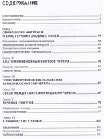 Венозные синусы черепа - один из ключей к мигреням