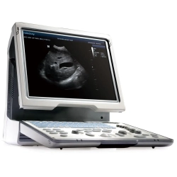 Аппарат УЗИ (сканер) Mindray DP-50