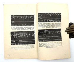 Гедеванишвили Д. М. (АВТОГРАФ) .О парной и раздельной работе больших полушарий головного мозга.1956г