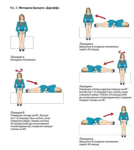 Отоневролог консультация маневры.