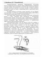 Остеотомии в области коленного сустава