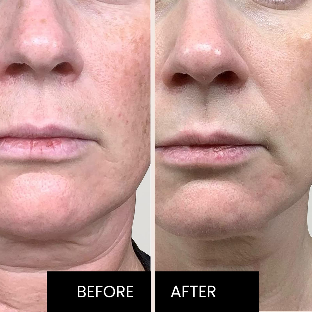 Kleem Organics, Jeunesse, профессиональная антивозрастная сыворотка с витамином C, 50 мл (1,7 жидк. унции)