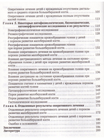 Врождённые пороки развития костей голени у детей