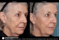 JAN MARINI AGE INTERVENTION RETINOL+ 0,5% Крем-акселератор с ретинолом 0,5% для борьбы с видимыми возрастными изменениями