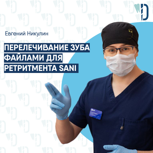 Перелечивание зуба файлами для ретритмента SANI