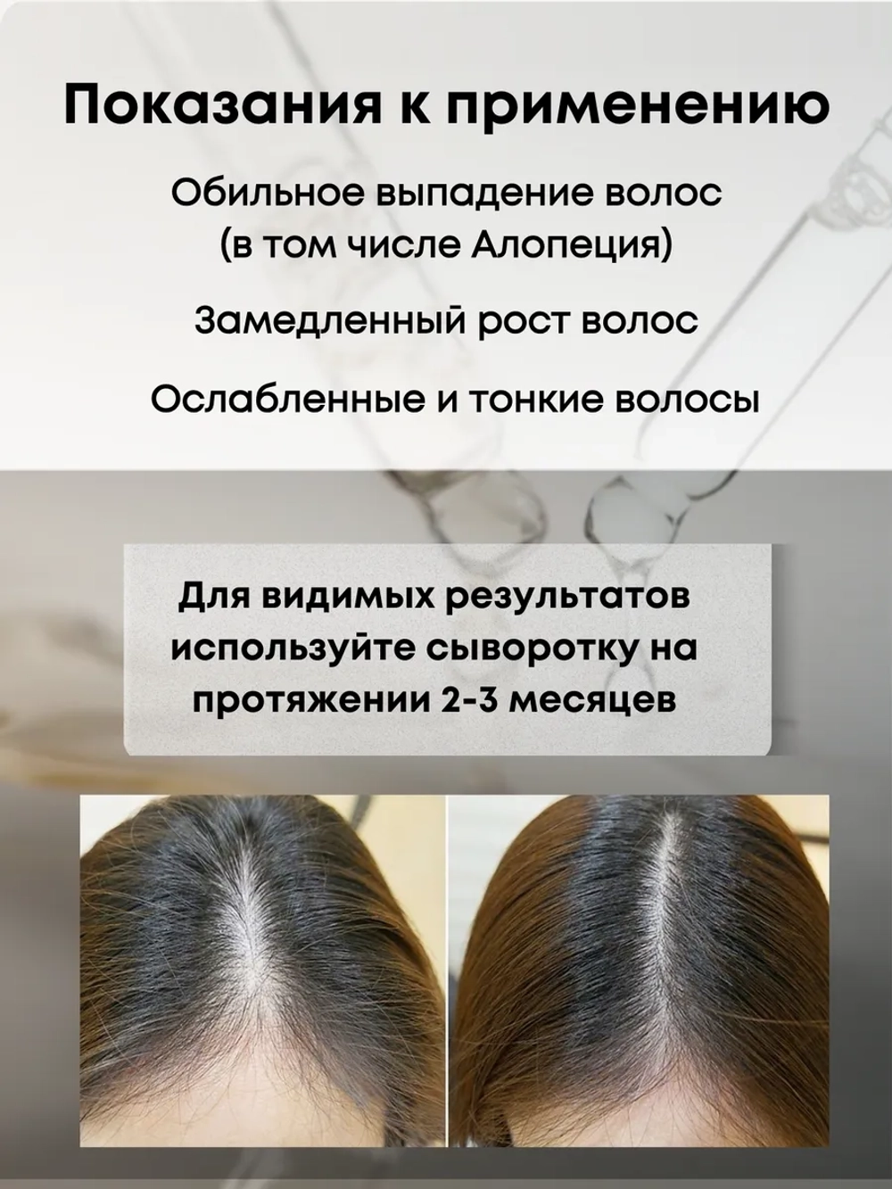 Лосьон - сыворотка для роста волос