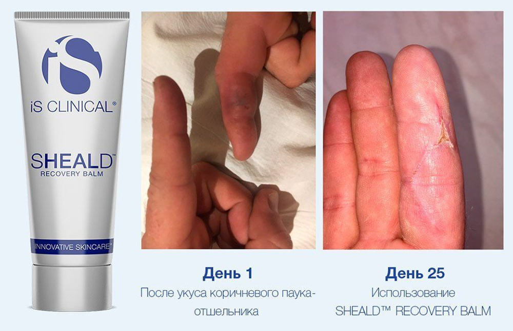 Is clinical SHEALD™ Recovery Balm 15 мл Бальзам защитный восстанавливающий -