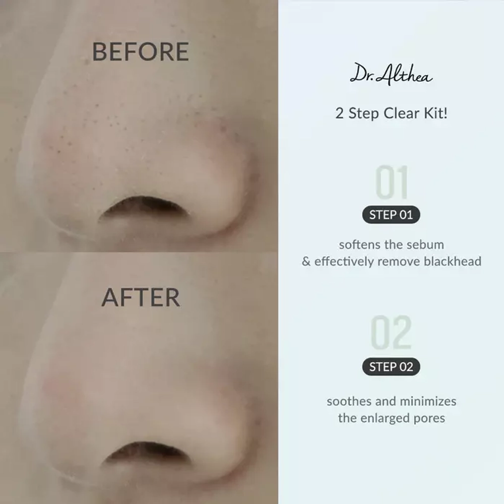Dr. Althea Pro Lab Blackhead Zero 2 Step Nose Patch