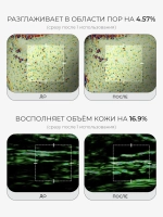 Medicube Сыворотка с микроиглами, ПДРН и экзосомами против морщин и пигментации PDRN Pink Collagen Exosome Shot 7500 30 мл