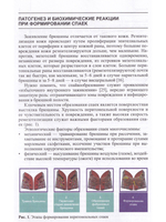 Профилактика спайкообразования при операциях на органах малого таза: Пособие для врачей