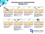 ОптиБонд ФЛ (OptiBond FL)