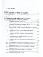Лучевая диагностика повреждений голеностопного сустава