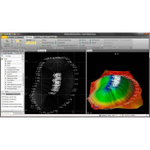 Обновление Trimble Business Center Surface Modeling до Survey Intermediate