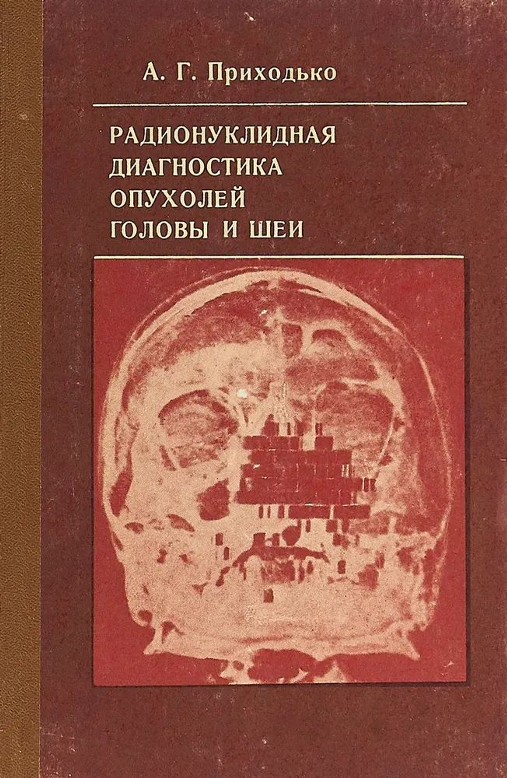 Радионуклидная диагностика опухолей головы и шеи