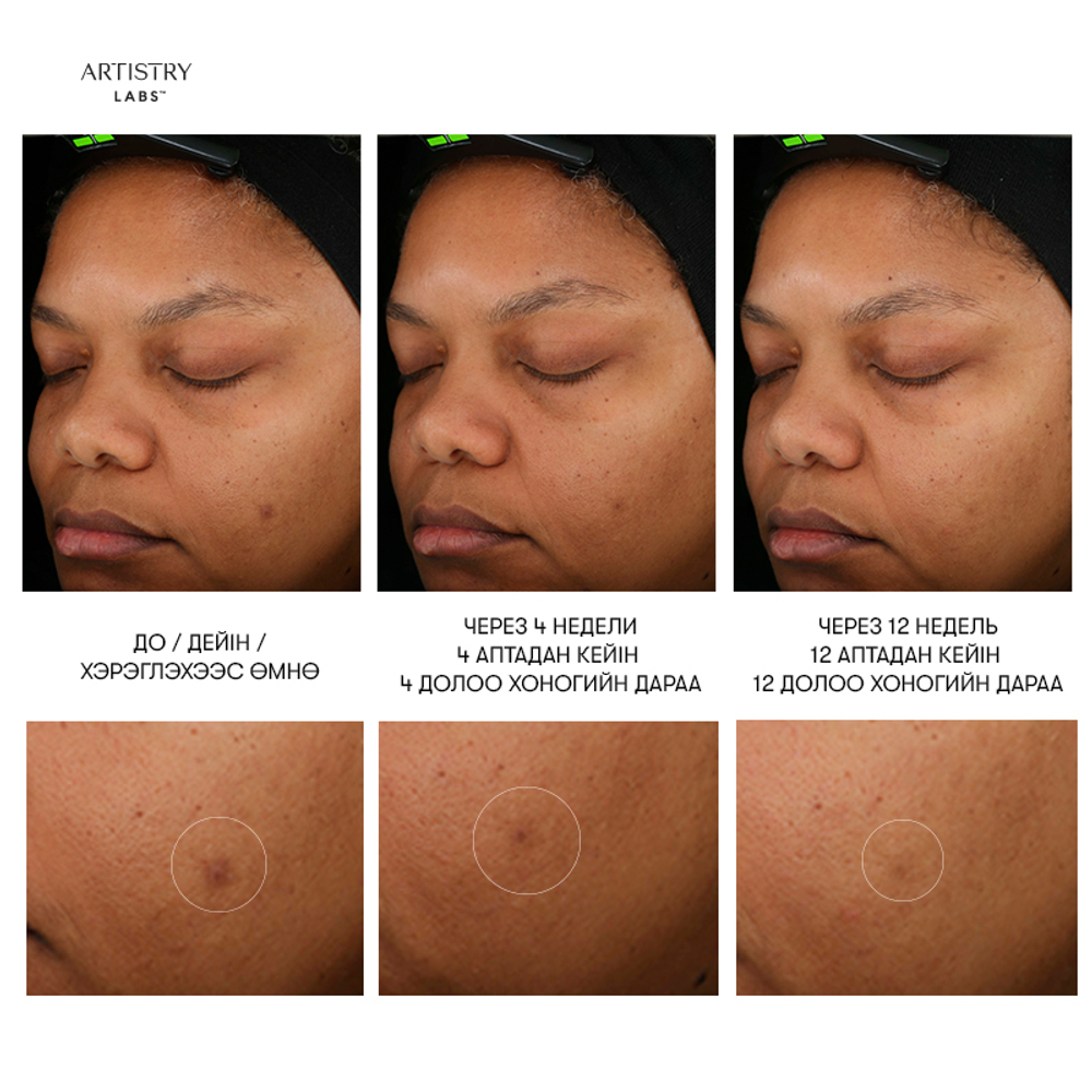 Artistry Labs Illuminating System™ Комплекс для осветления кожи лица